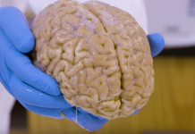 بانک مغز انسان در هاروارد برای تشخیص مشکلات پزشکی
