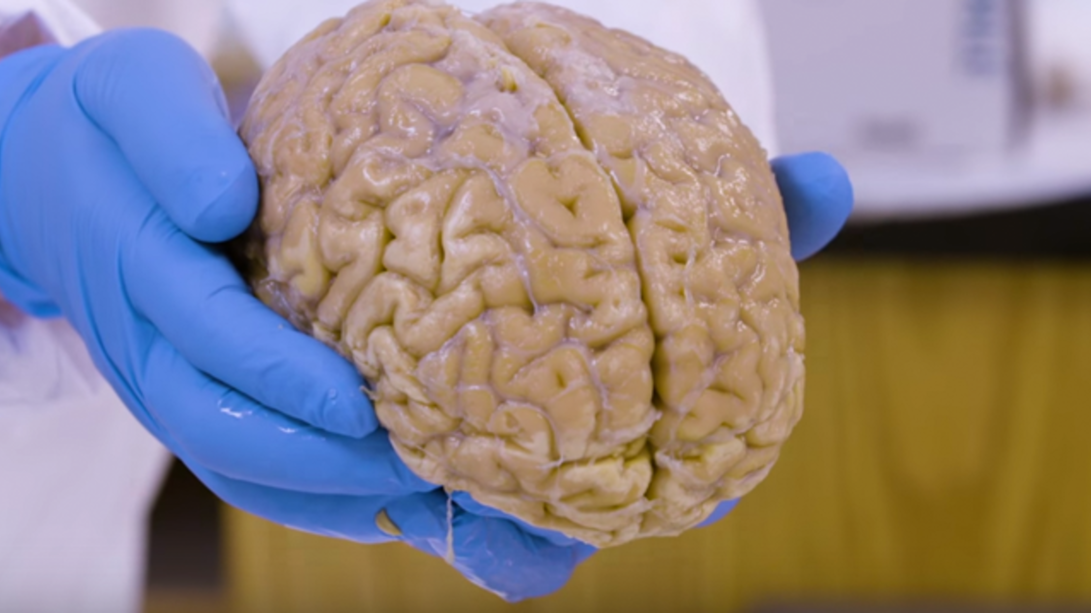 بانک مغز انسان در هاروارد برای تشخیص مشکلات پزشکی