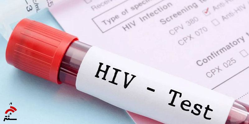 داروی جدید HIV
