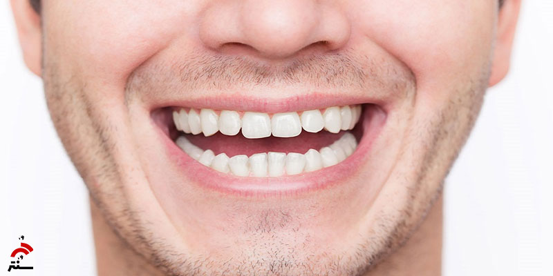 تفاوت دندان ها و استخوان ها