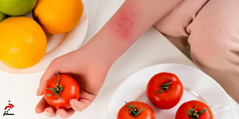 افراد مبتلا به آلرژی غذایی